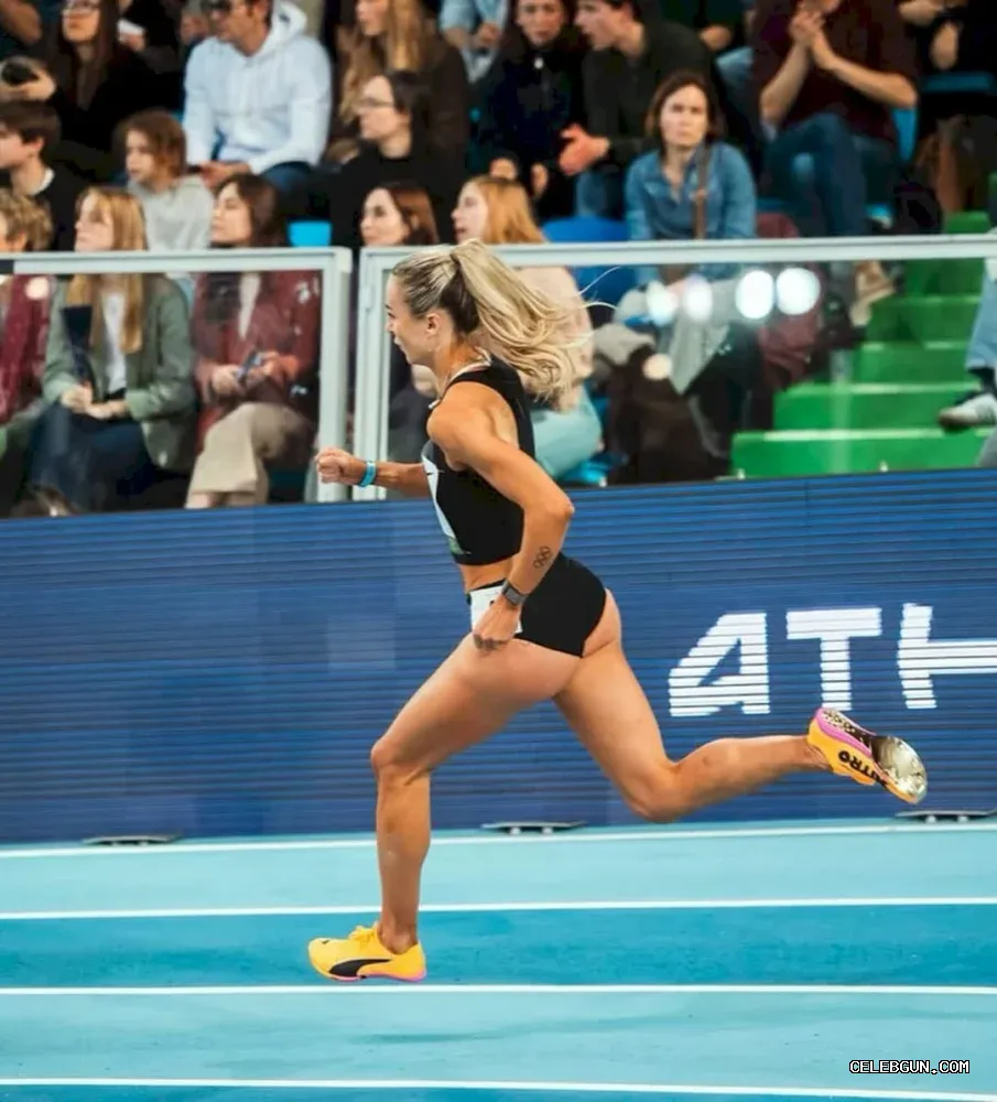 Sharlene Mawdsley’s Hot Legs: Stunning Sexy Photo Collection